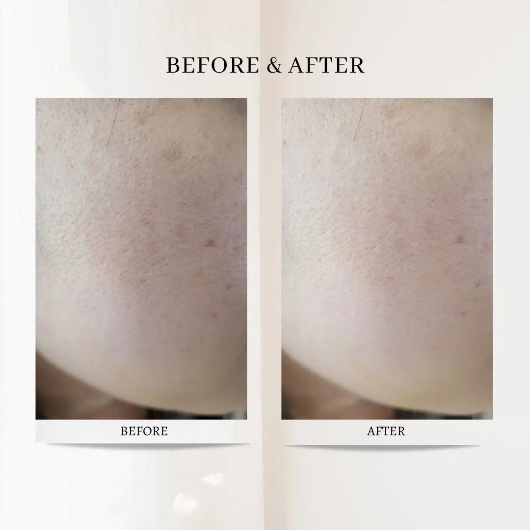 Beauty Factory Triple Hyaluronic Acid Serum - Miessential