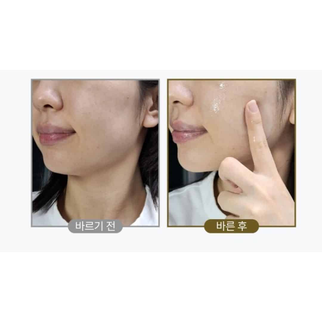 Eseria 7 hybrid solution care essence