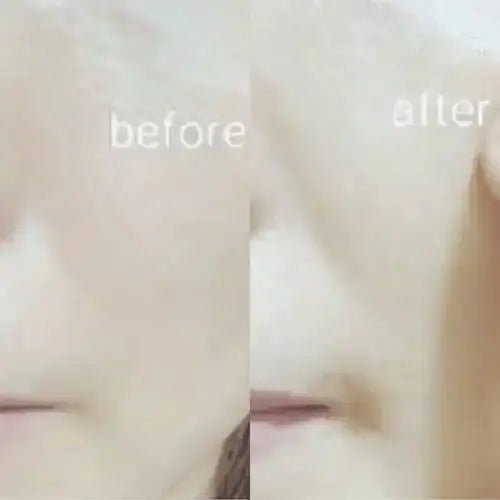 Ja Yeon Mapping Mask Family Bundle (48 PCS) - Miessential