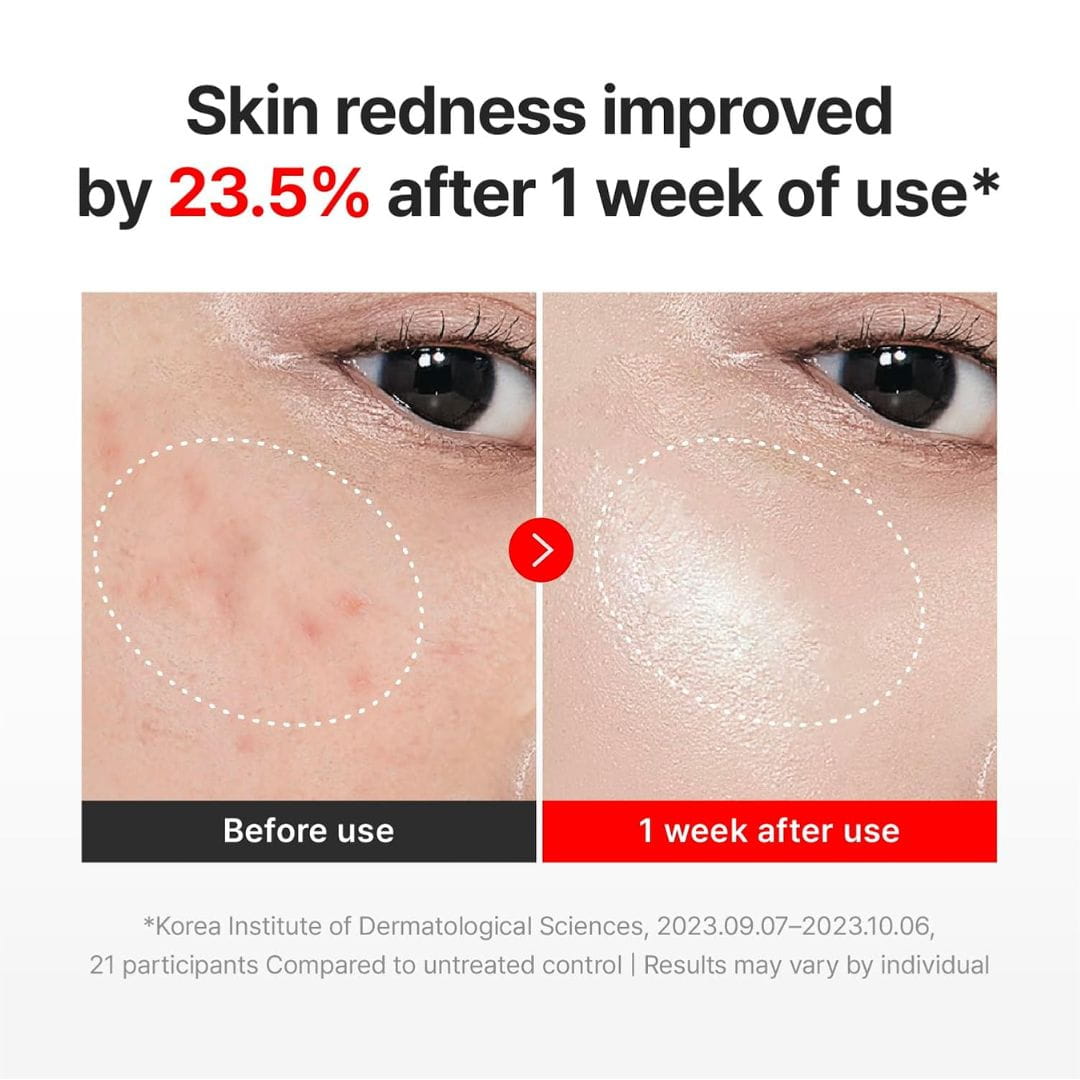 Centellian24 Madeca Cream Time Reverse