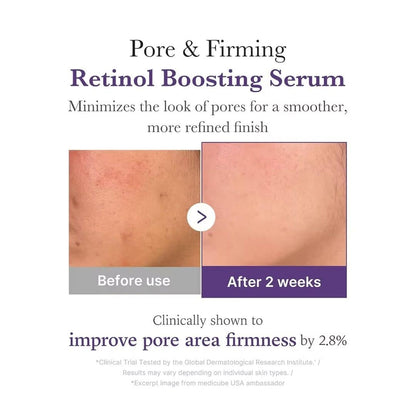Medicube Retinol NMN Boosting Serum 1.9% Retinol-Some