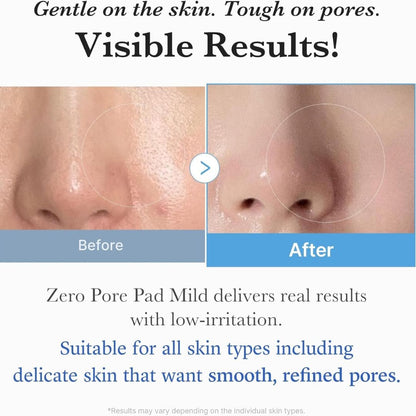 Medicube Zero Pore Pad Mild